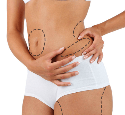Ondas de choque para eliminar la celulitis en el Vendrell 