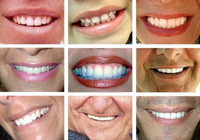 LABORATORIO DENTAL ALICANTE laboratorio dental alicante: